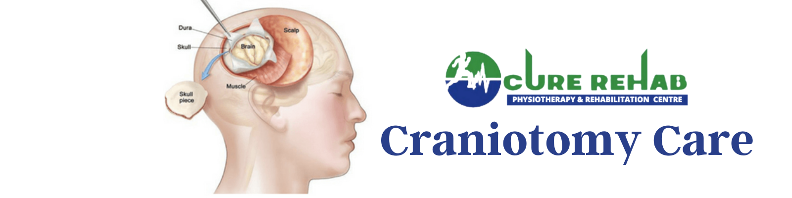 Craniotomy Care